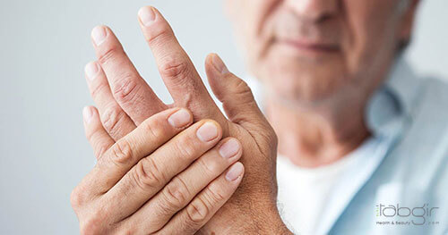 تورم انگشتان ناشی از آرتریت
