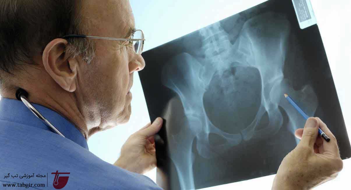 تشخیص کاهش تراکم استخوان با رادیولوژی