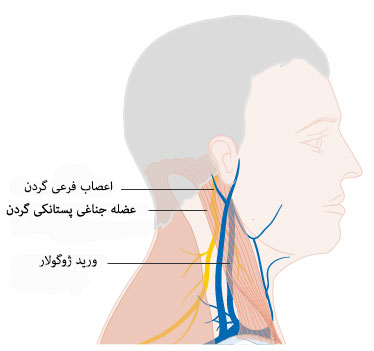 عوارض برداشتن غدد لنفاوی گردن