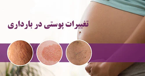 مشکلات پوستی در بارداری