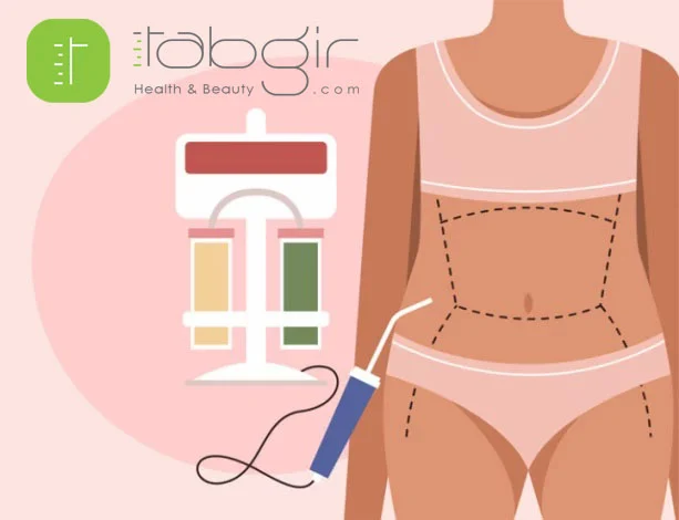 لیپوماتیک ۳۶۰ درجه چیست؟